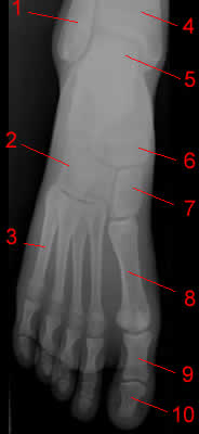 foot x-ray ap