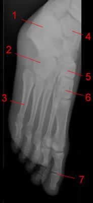 foot x-ray oblique