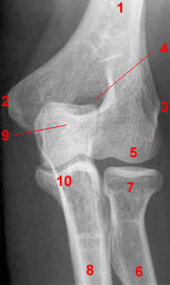 Elbow Radiograph - AP projection
