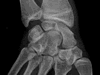 Wrist radiographs. Image 2