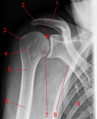 Shoulder X-ray, AP projection