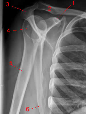 Shoulder X-ray, Lateral Projection