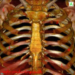 Radiographie du thorax: cliché de face.